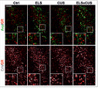 DNA Methylation Profiles and Biomarkers of Oral Squamous Cell Carcinoma